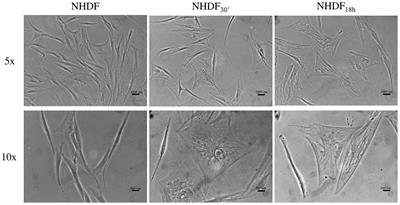 Tumor-Derived Extracellular Vesicles Activate Normal Human Fibroblasts to a Cancer-Associated Fibroblast-Like Phenotype, Sustaining a Pro-Tumorigenic Microenvironment